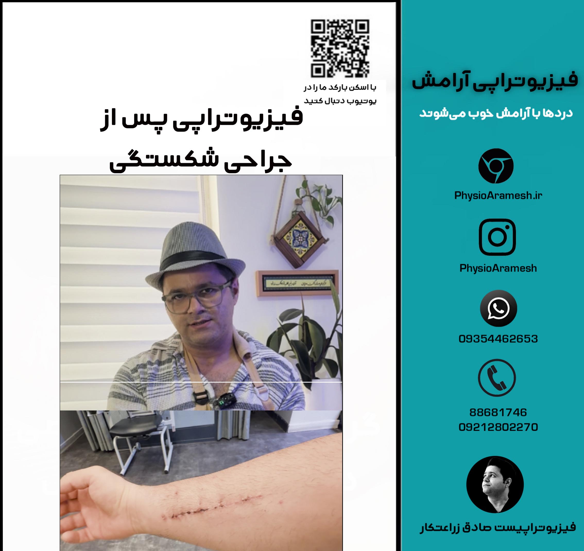 فیزیوتراپی بعد از جراحی شکستگی